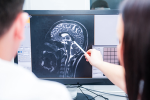 Radiologist is pointing to a skull MRI X-RAY on a screen.